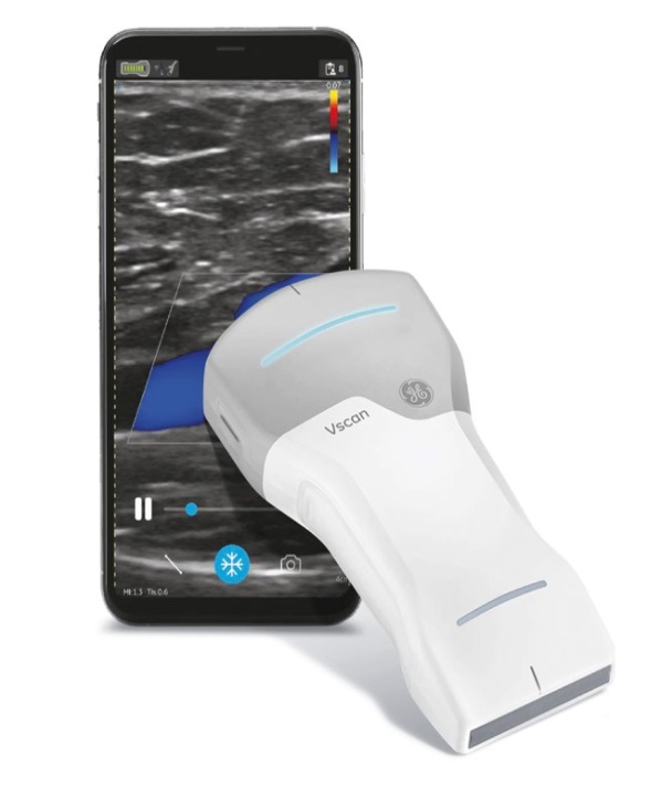 SONO VSCAN AIR CL ULTRAZVUK OD GE