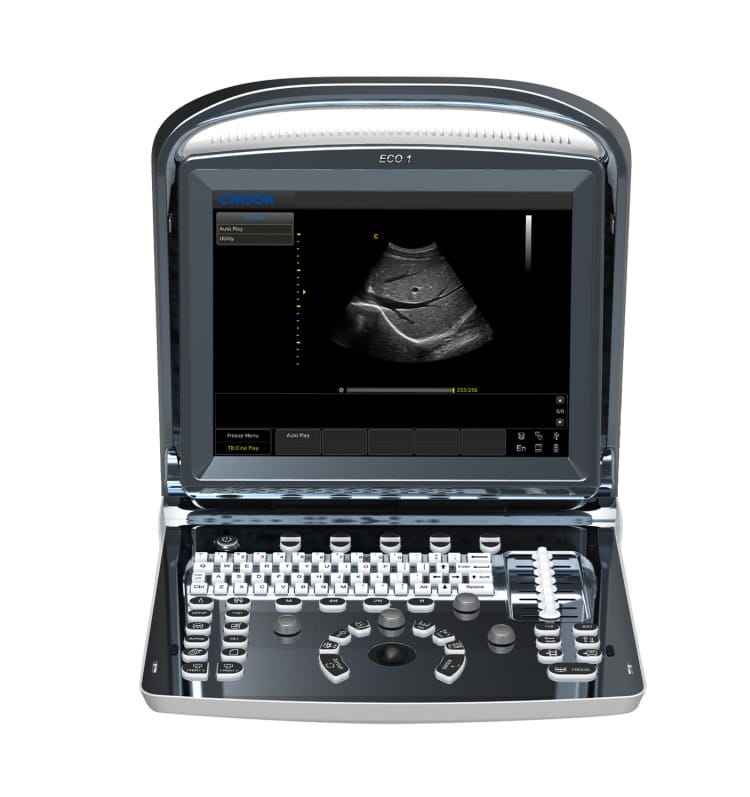 Chison ECO 1 Ultrasound Machine bez dobíjecí baterie s lineární sondou L7M‑A