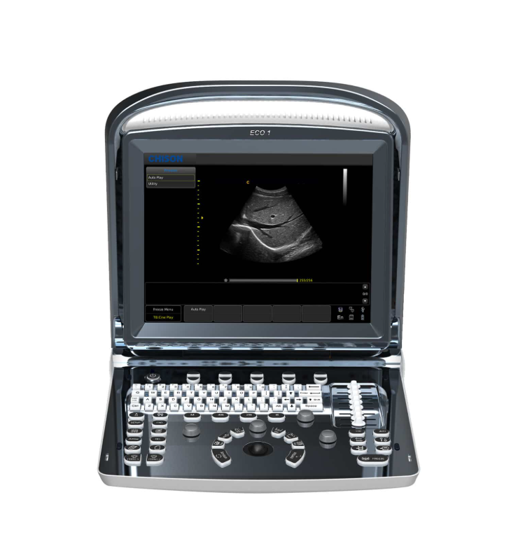 Chison ECO 1 Ultrasound Machine s dobíjecí baterií a lineární sondou L7M‑A